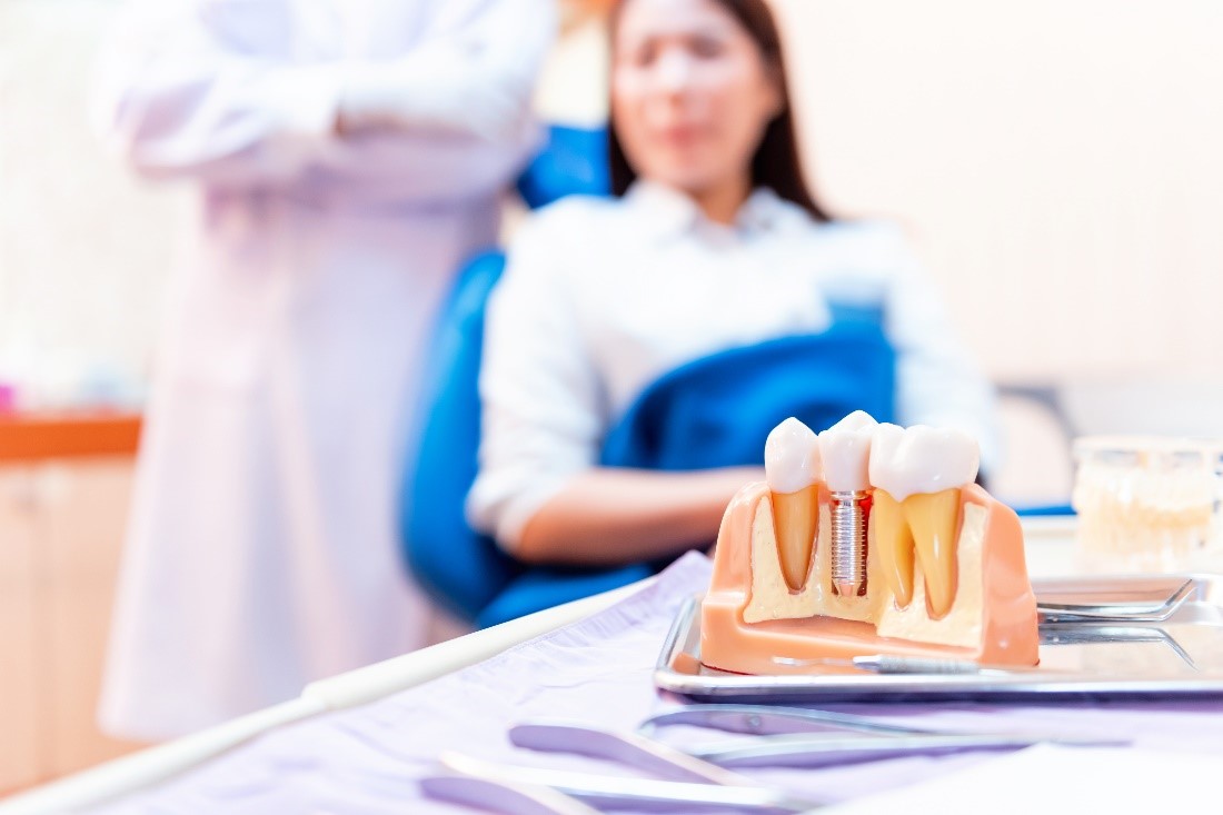 7 Key Factors That Affect The Cost Of Dental Implants