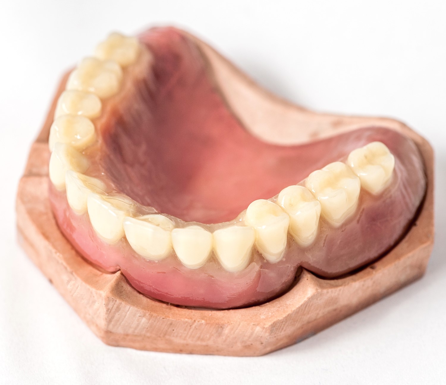 Immediate Upper Denture, Dentex Dental