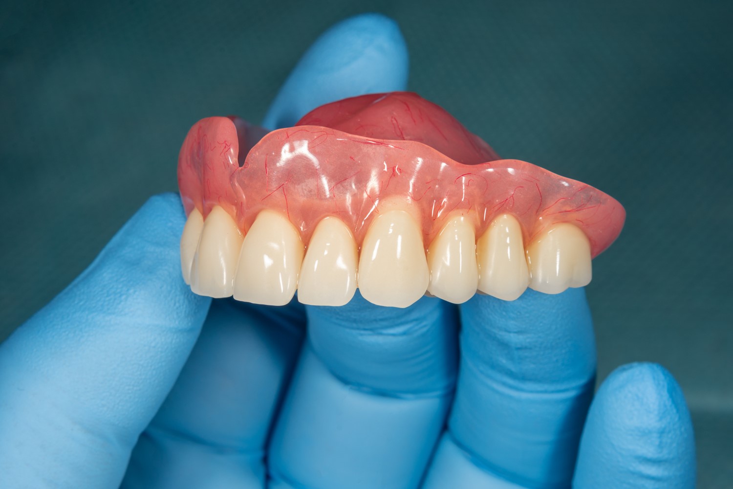 The Average Cost Of Denture Implants Today