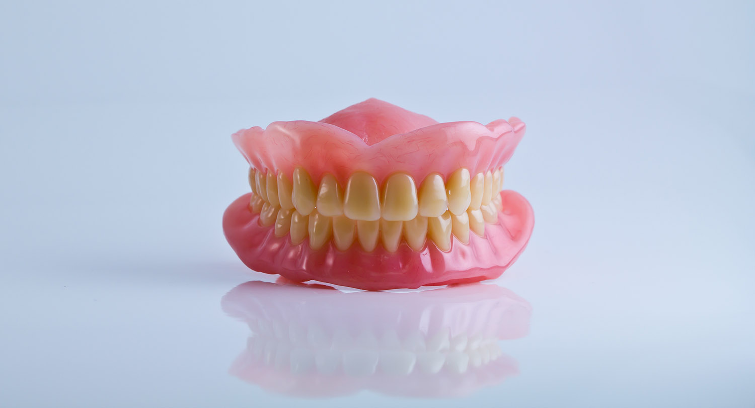 Differences Between Implant Retained And Implant Supported Dentures