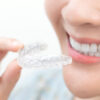 Blog, Dentex Dental