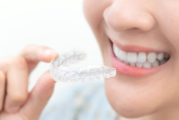 Mouth Guard 600x403, Dentex Dental