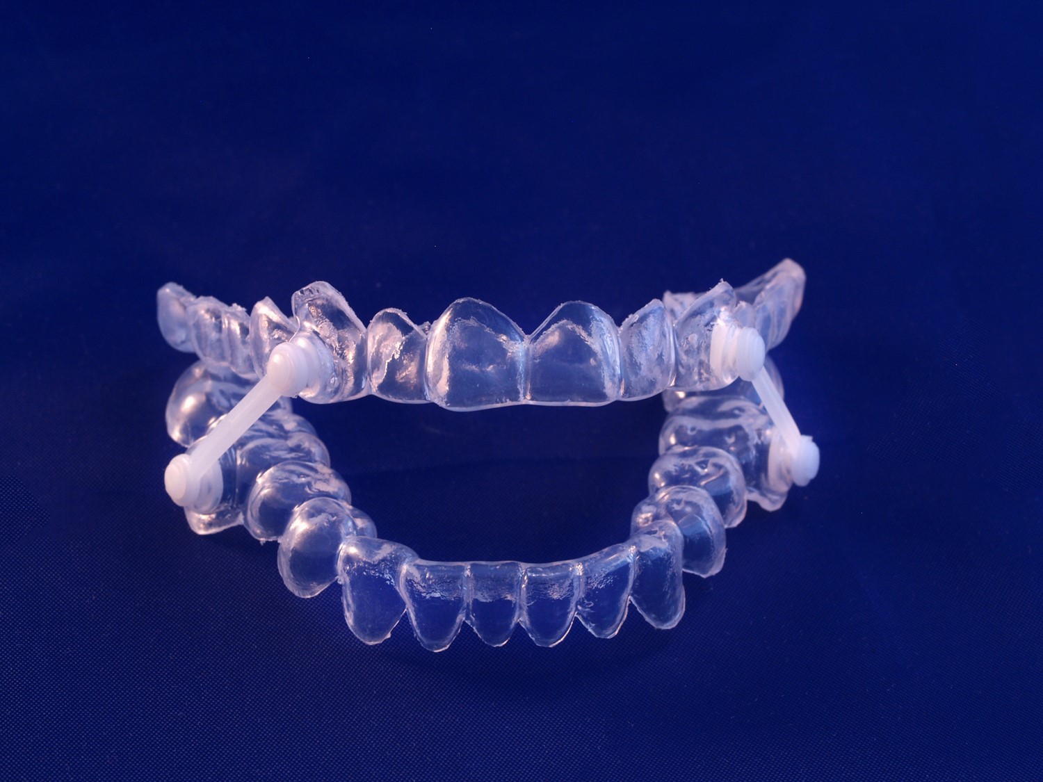 The Role of Mouth Guards in Treating Sleep Apnea